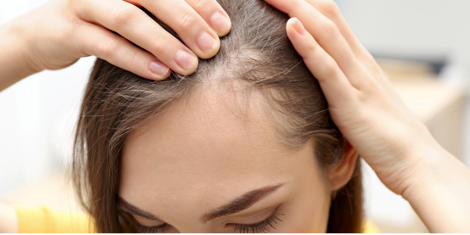 What Alopecia Is — and What People Often Misunderstand